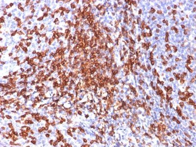 CD44 Standard Monoclonal Mouse Antibody (156-3C11)