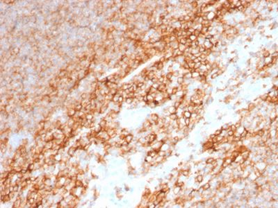 CD44 Standard Monoclonal Mouse Antibody (BU75)