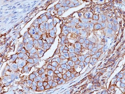 CD44 Standard Monoclonal Mouse Antibody (DF1485)