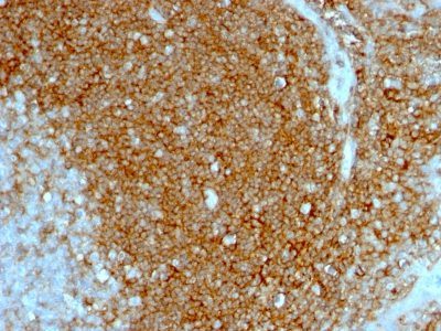 CD44 Standard Monoclonal Mouse Antibody (HCAM/1097)