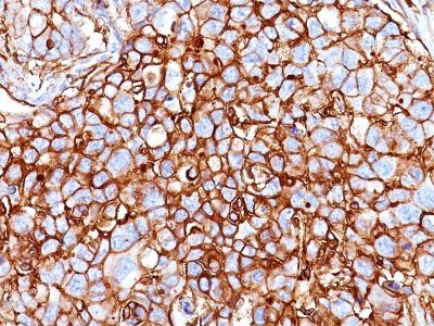 CD44 Standard Monoclonal Mouse Antibody (HCAM/918)