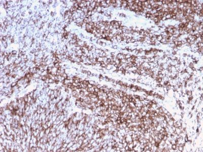 CD44 Standard Recombinant Monoclonal Mouse Antibody (rHCAM/918)