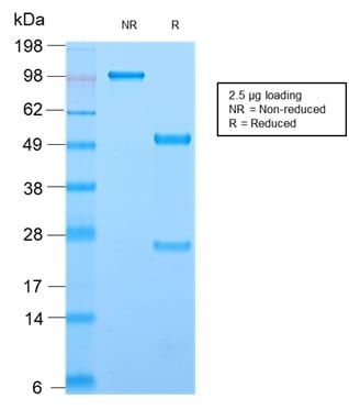 CD44 Standard Recombinant Monoclonal Rabbit Antibody (HCAM/2875R)