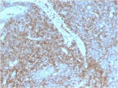 CD44 Standard Recombinant Monoclonal Rabbit Antibody (HCAM/2875R)