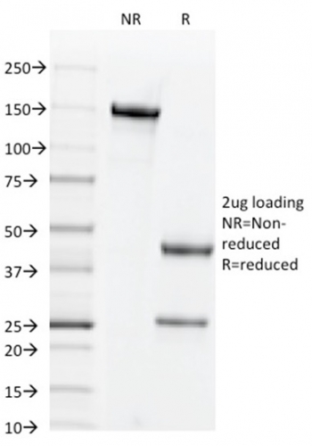 CD44v6 Monoclonal Mouse Antibody (2F10)