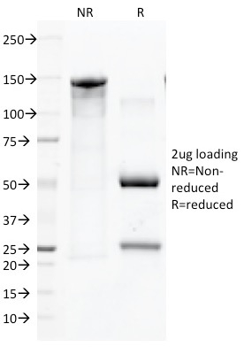 CD45 / LCA Monoclonal Mouse Antibody (136-4B5)