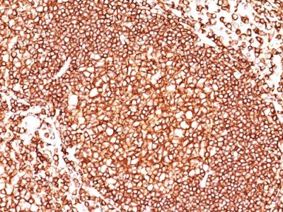 CD45 / LCA Monoclonal Mouse Antibody (136-4B5)