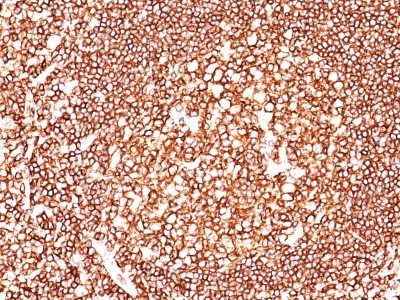 CD45 / LCA Monoclonal Mouse Antibody (2B11 + PD7/26)