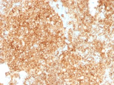 CD45 / LCA Monoclonal Mouse Antibody (PTPRC/1147 + PTPRC/1460)