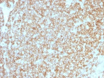 CD45 / LCA Recombinant Monoclonal Rabbit Antibody (PTPRC/1783R + PTPRC/1975R)
