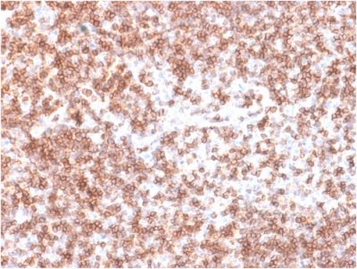 CD45 / LCA Recombinant Monoclonal Rabbit Antibody (PTPRC/1975R)