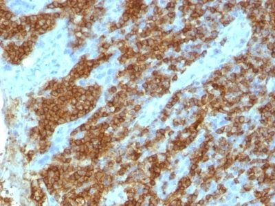 CD45RA Monoclonal Mouse Antibody (111-1C5)