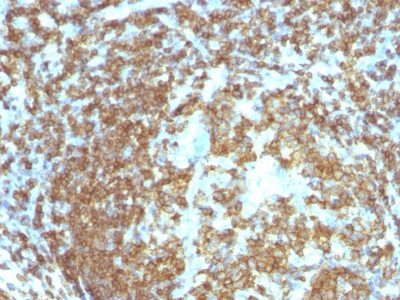 CD45RA Monoclonal Mouse Antibody (158-4D3)