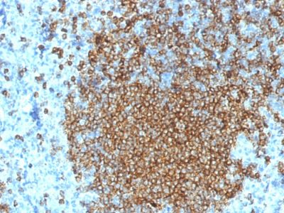 CD45RA Monoclonal Mouse Antibody (K4B5)