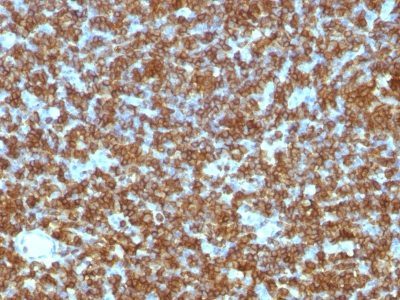 CD45RA Monoclonal Mouse Antibody (PTPRC/1131)