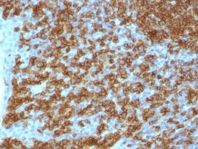 CD45RA Monoclonal Mouse Antibody (PTPRC/1148)