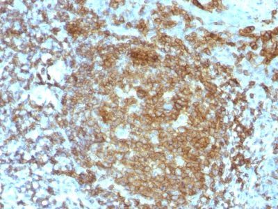 CD45RA Monoclonal Mouse Antibody (PTPRC/818)