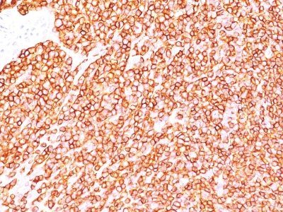 CD45RB Monoclonal Mouse Antibody (BRA-11G)