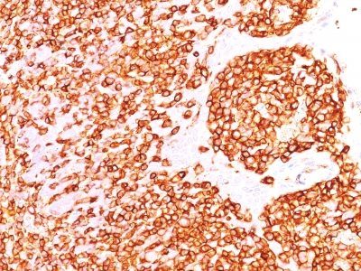 CD45RB Monoclonal Mouse Antibody (DF-B1)