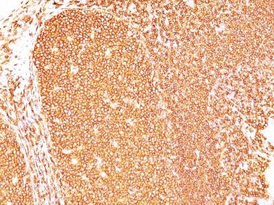 CD45RB Monoclonal Mouse Antibody (PD7/26)