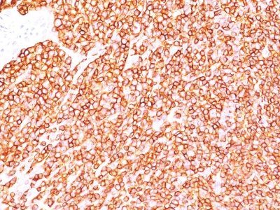 CD45RB Monoclonal Mouse Antibody (PD7/26)