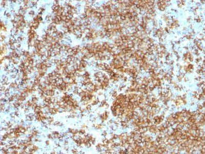 CD45RB Monoclonal Mouse Antibody (PTPRC/1132)