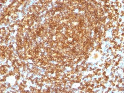 CD45RB Monoclonal Mouse Antibody (PTPRC/1132)