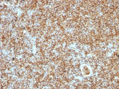 CD45RB Monoclonal Mouse Antibody (PTPRC/1147)