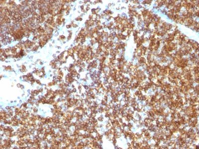 CD45RB Monoclonal Mouse Antibody (PTPRC/1147)