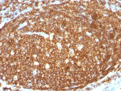CD45RB Polyclonal Rabbit Antibody (N/A)