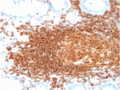 CD45RB Recombinant Monoclonal Mouse Antibody (rPTPRC/1132)