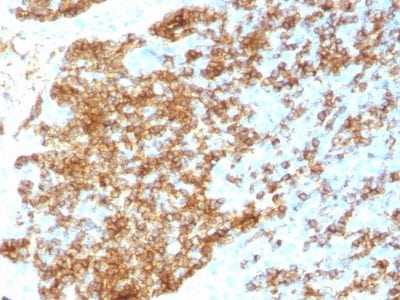 CD45RB Recombinant Monoclonal Rabbit Antibody (PTPRC/1783R)