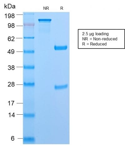 CD45RB Recombinant Monoclonal Rabbit Antibody (PTPRC/2877R)
