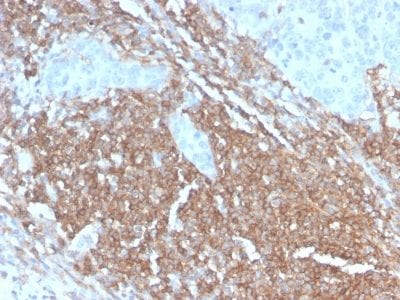 CD45RB Recombinant Monoclonal Rabbit Antibody (PTPRC/2877R)