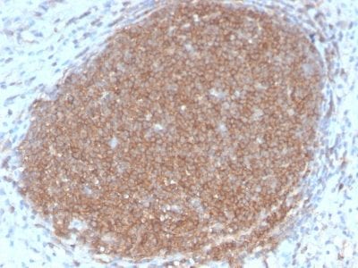 CD45RB Recombinant Monoclonal Rabbit Antibody (PTPRC/2877R)