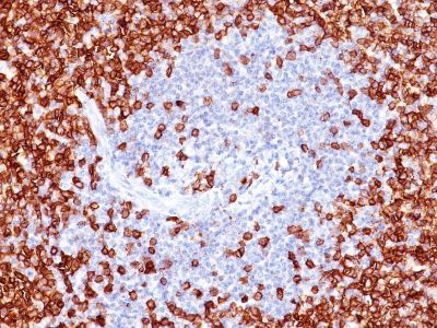 CD45RO Monoclonal Mouse Antibody (T200/797)