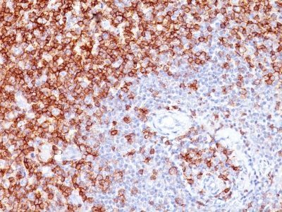 CD45RO Monoclonal Mouse Antibody (UCHL-1 + T200/797)