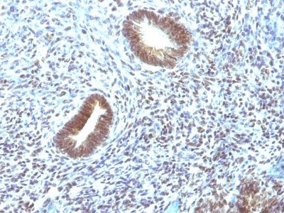 CD46 Monoclonal Mouse Antibody (197-2B1)