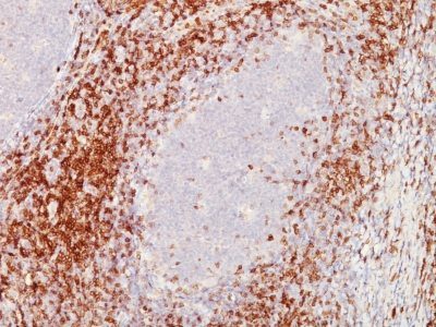 CD5 Monoclonal Mouse Antibody (C5/473 + CD5/54/F6)
