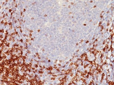 CD5 Monoclonal Mouse Antibody (C5/473)