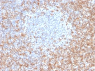 CD5 Monoclonal Mouse Antibody (CD5/2416)
