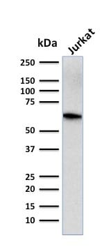 CD5 Monoclonal Mouse Antibody (CD5/2416)