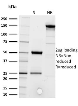 CD5 Monoclonal Mouse Antibody (CD5/2416)