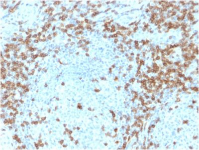 CD5 Monoclonal Mouse Antibody (CD5/2418)