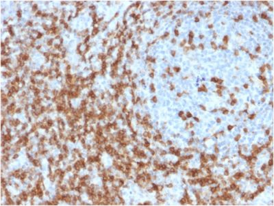 CD5 Monoclonal Mouse Antibody (CD5/2419)