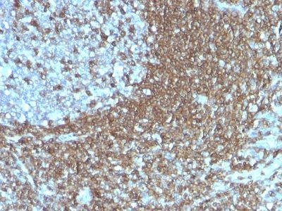 CD50 Monoclonal Mouse Antibody (186-2G9)