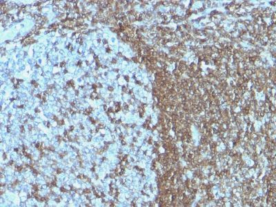 CD50 Monoclonal Mouse Antibody (ICAM3/1019)