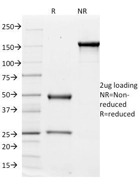 CD51 / Integrin V Monoclonal Mouse Antibody (ITGAV/1610)