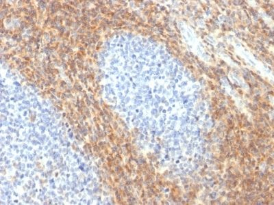CD52 Recombinant Monoclonal Rabbit Antibody (CD52/2276R)