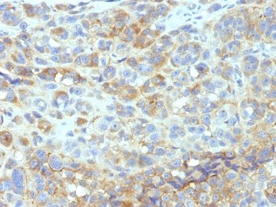 CD54 / ICAM-1 Monoclonal Mouse Antibody (1H4 + or + Wehi-CAM-1 + or + W-CAM-1)